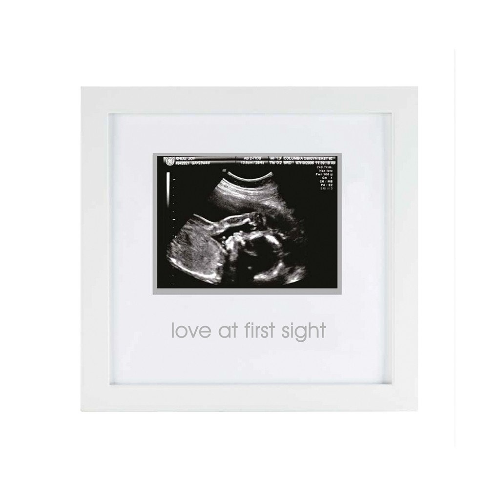 Ultrasound discount picture frame